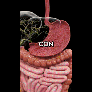 Vinagre De Manzana Goma X60und Fitovit